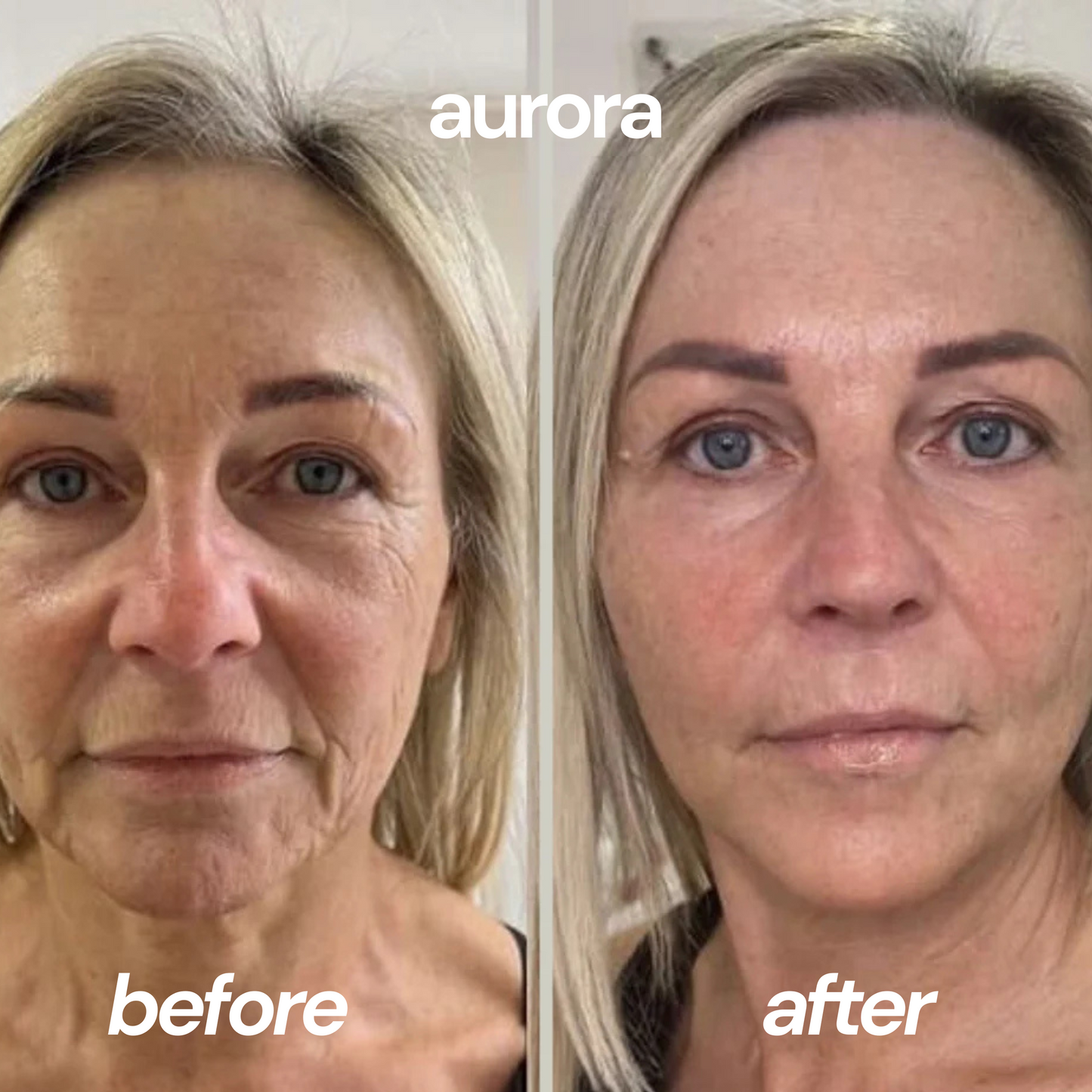 VIRAL KOREAN COLLAGEN MASK