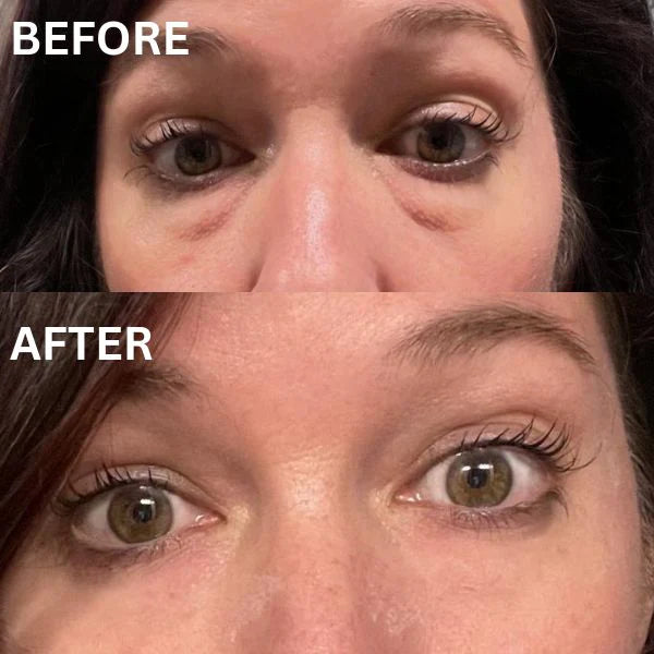 COLLAGEN EYE PATCHES