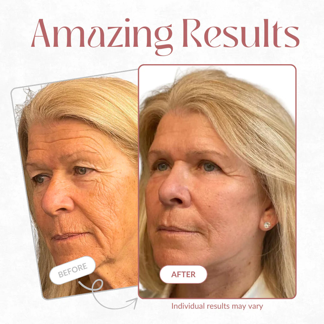 Botox Stick