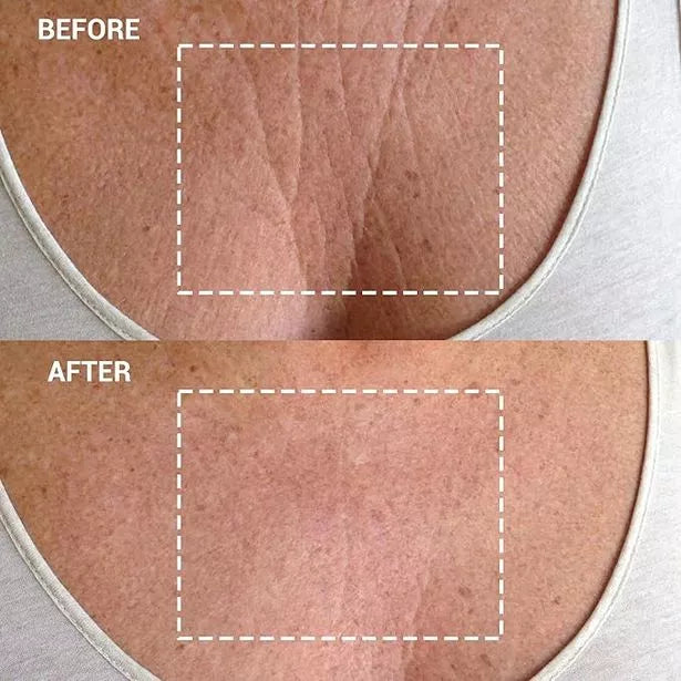 ANTI WRINKLE PATCHES CHEST