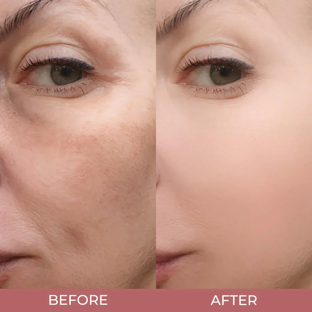 Glass Skin Peel