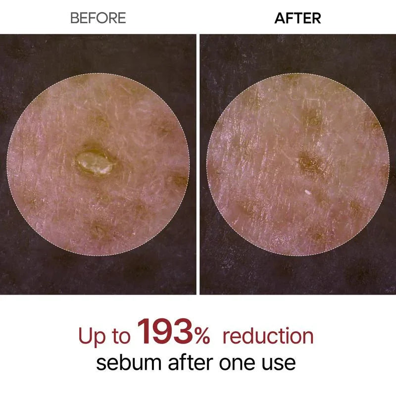 Glass Skin Peel